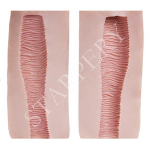 Starpery Vaginal Type A